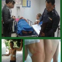 Ein Vater und sein Sohn wurden von einem Schlägertrupp in Chiang Mai mit Holzknüppeln angegriffen und verletzt.
