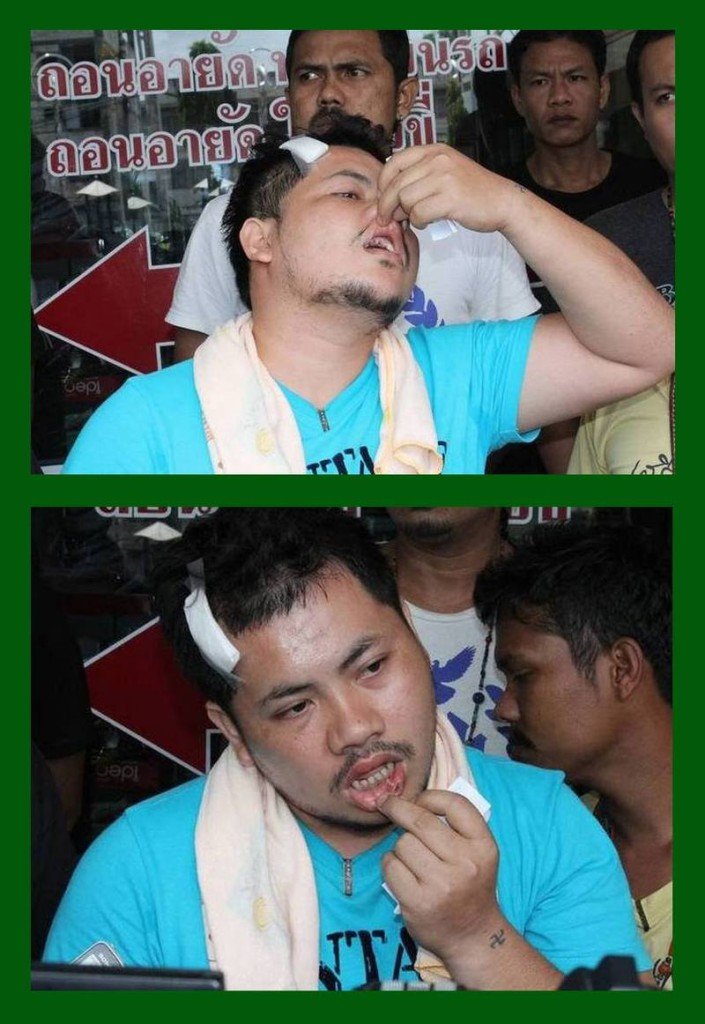 Das Opfer der Polizeigewalt auf Phuket berichtet weiter über seine Misshandlung