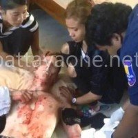 Norweger verstümmelt sich selber mit einer Glasscherbe