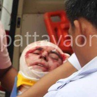 Schotte fällt aus seinem Hotelzimmer im fünften Stock