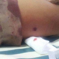 12-jähriger Junge in der Schule auf Phuket angeschossen