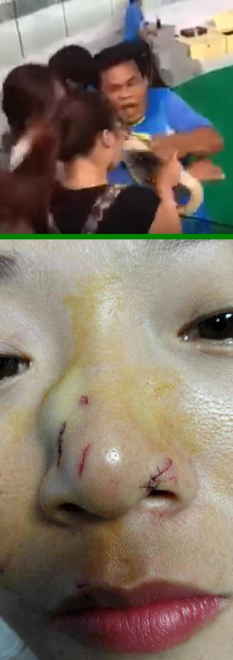 Chinesische Touristin während einer Show auf Phuket von Python ins Gesicht gebissen