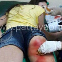 Russische Touristin auf Ko Lan vom Affen gebissen