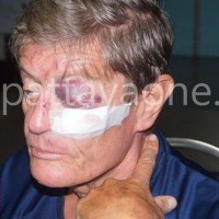 Ein Brite und ein Deutscher von Barpersonal in Pattaya angegriffen