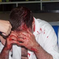 Kanadier nach Streit um Barrechnung in Pattaya schwer verletzt