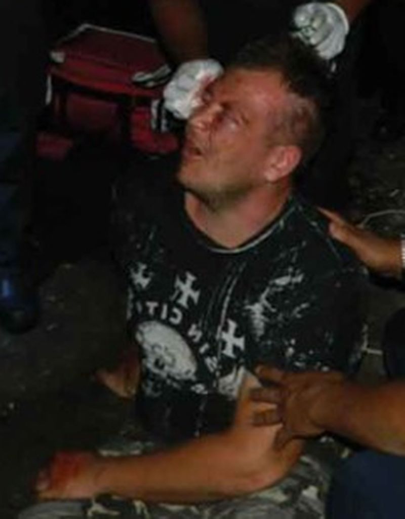 Betrunkener Russe vom Personal eines Nachtclubs angegriffen