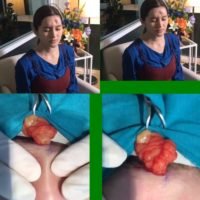 Abschreckendes Video für Frauen, die von einer Schönheits-OP träumen
