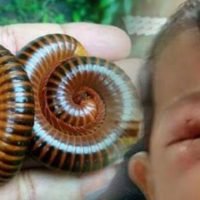 Eine Mutter berichtet, dass ihr kleiner Junge durch das Gift eines Tausendfüßler fast erblindet wäre.