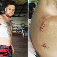 Schwede sticht auf Ko Chang 16 Mal auf einen Briten ein und wird auf Kaution freigelassen