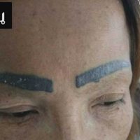 Nach einem verpfuschten Augenbrauen Tattoo warnt eine Thailänderin alle anderen Frauen