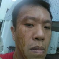 Ein Aktivist, der wissen will, wo Prawit seine Luxus Uhren herhat, wurde mit fermentiertem Fisch beworfen