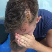Deutscher Tourist kommt bei einem Angriff auf Phuket fast ums Leben
