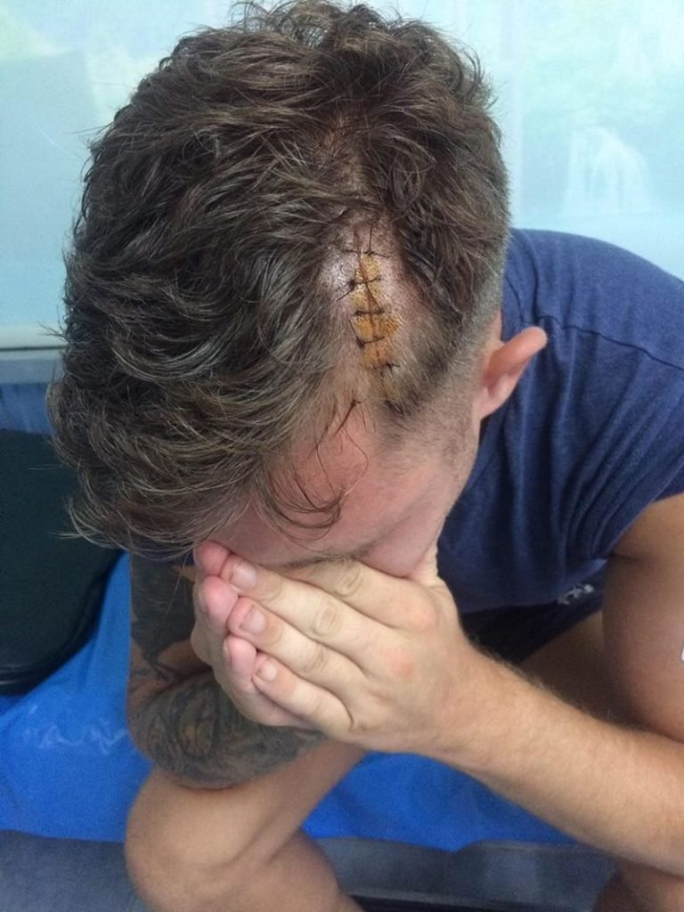 Deutscher Tourist kommt bei einem Angriff auf Phuket fast ums Leben