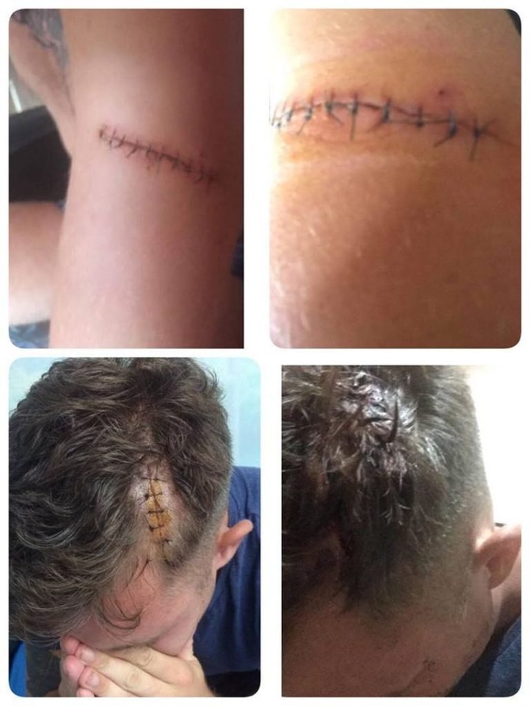 Nachtrag zum Überfall eines Deutschen in Chalong auf Phuket