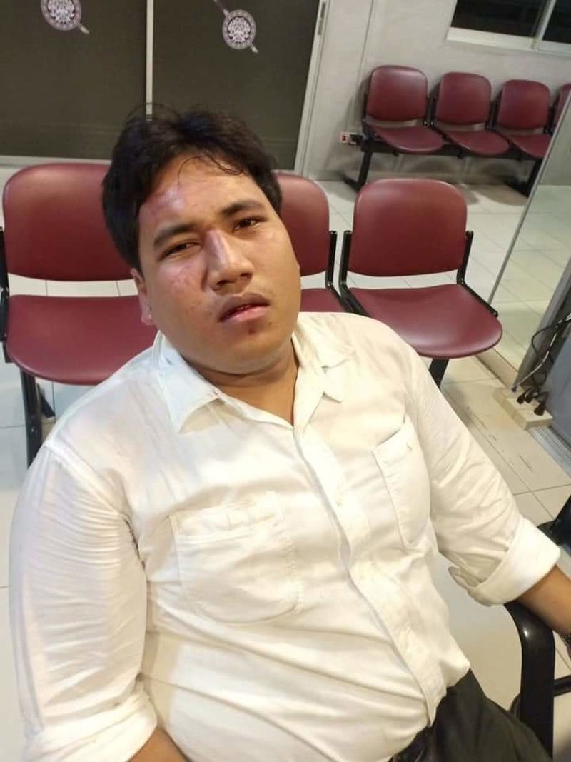 Anti-Junta Aktivist Ja New wird erneut von unbekannten Männern angegriffen