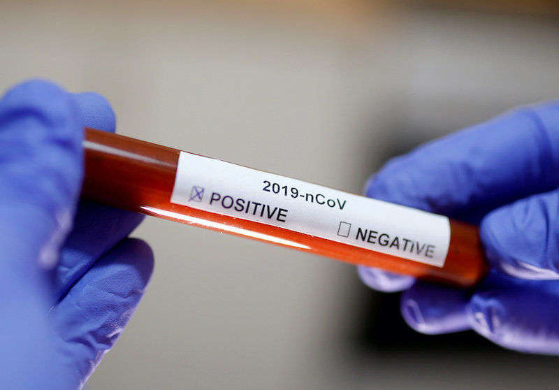 US-Gentech Firma meldet die Fertigstellung eines Coronavirus Impfstoff
