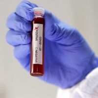 Thailand bestätigt den zweiten inländischen COVID-19 Fall in ebenso vielen Tagen - diesmal in Chiang Rai