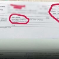 Frau wusste, dass sie Covid-19 hatte und besuchte trotzdem Ihre Familie