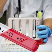 1.662 Patienten schwerkrank und 470 an Beatmungsgeräten, da die Virusausbreitung keine Anzeichen einer Verlangsamung zeigt