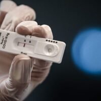 Lokale Forscher entwickeln Covid-19 Antigen Schnelltests