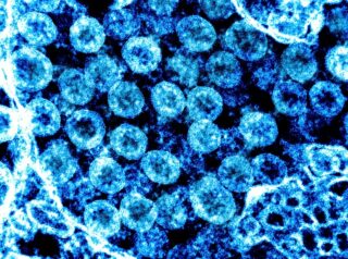 Ein Handout Foto des National Institute of Allergy and Infectious Diseases zeigt eine durch Transmissionselektronen verstärkte mikroskopische Aufnahme von SARS-CoV-2-Viruspartikeln