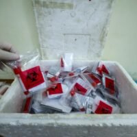 Die Coronavirus Fälle sind in den letzten Wochen weltweit angestiegen, angeheizt durch das Aufkommen der hoch übertragbaren Omicron Variante.