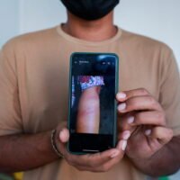 Lin Lin Bo Bo, dessen Eltern die Verbindung zu ihm abgebrochen haben, zeigt ein Bild der Wunden seiner Mutter