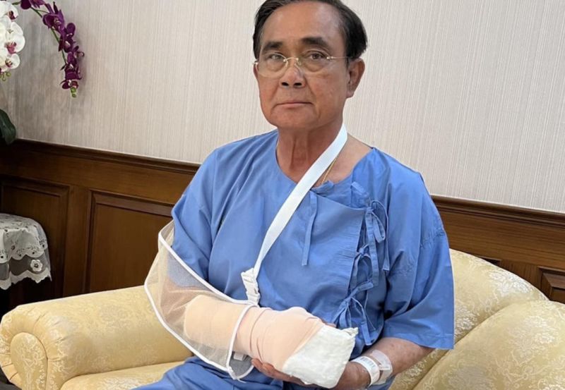 Ärzte behalten Premierminister Prayuth Chan o-cha über Nacht zur Beobachtung im Krankenhaus, nachdem sie am Samstag bei der Untersuchung seiner geschwollenen rechten Hand eine Anomalie festgestellt hatten. General Prayuth suchte eine Behandlung im Phramongkutklao Krankenhaus in Bangkok auf, nachdem er am Freitag (3. März) von einer Inspektions- und Verdienstreise nach Ayutthaya mit schweren Schwellungen und Infektionen in der Hand zurückgekehrt war.