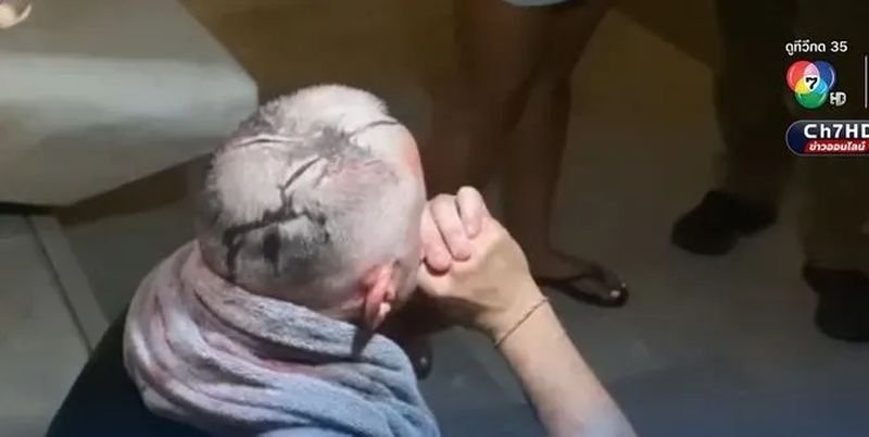 Ein einsamer Brite, der die Dienste zweier Frauen in Anspruch genommen hatte, war fassungslos, als stattdessen vier Transgender-Sexarbeiterinnen in seine Wohnung in Pattaya kamen. Als er sie abwies und sich weigerte, die geforderten 10.000 Baht pro Person zu zahlen, wurde ihm der Kopf schwer aufgeschlitzt, berichtete der Fernsehsender Channel 7 am Freitag Morgen (12. September).