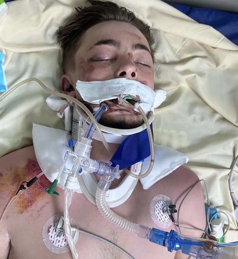 Ein britischer Tourist kämpft um sein Leben, nachdem er in Pattaya Berichten zufolge von einem fahrenden Pickup-Truck gefallen und überfahren worden war. Der 20-jährige Ethan Lacey aus Birmingham, der sich für eine Thailandreise zwei Monate Urlaub von seinem Fabrikjob genommen hatte, liegt nach dem Unfall am 16. Mai mit lebensgefährlichen Kopfverletzungen in einem Krankenhaus in Bangkok im Koma.